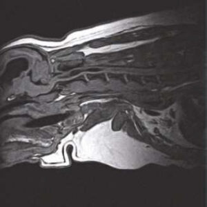 T1 3D FLASH Sagittal